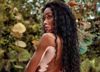 Звезды, прославившиеся благодаря своей необычной внешности