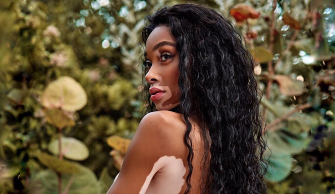 Звезды, прославившиеся благодаря своей необычной внешности